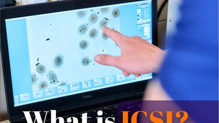 What is ICSI?