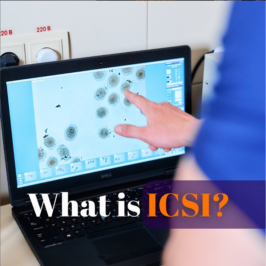 What is ICSI?